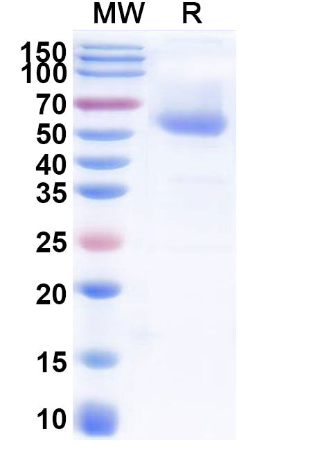 Recombinant Human Cerebellin-2/CBLN2 Protein, C-Fc