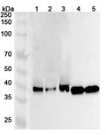 Western blot analysis was performed using anti-PDHA2 polyclonal antibody at 1ug/mL on various samples.
Lane 1: Mouse brain lysate
Lane 2: Mouse kidney lysate
Lane 3: Mouse testis lysate
Lane 4: Rat brain lysate
Lane 5: Rat kidney lysate