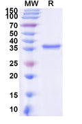Recombinant Human EPAS1 Protein, N-His