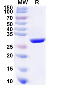 Recombinant Human COL9A1 Protein, N-His