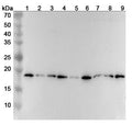 Western blot analysis was performed using anti-RPL12 polyclonal antibody at 1ug/mL on various samples.
Lane 1: Hela cell lysate
Lane 2: A549 cell lysate
Lane 3: Jurkat cell lysate
Lane 4: 293T cell lysate
Lane 5: NIH3T3 cell lysate
Lane 6: HepG2 cell lysate
Lane 7: Lncap cell lysate
Lane 8: K562 cell lysate
Lane 9: Raji cell lysate