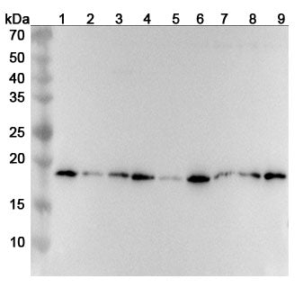 Western blot analysis was performed using anti-RPL12 polyclonal antibody at 1ug/mL on various samples.
Lane 1: Hela cell lysate
Lane 2: A549 cell lysate
Lane 3: Jurkat cell lysate
Lane 4: 293T cell lysate
Lane 5: NIH3T3 cell lysate
Lane 6: HepG2 cell lysate
Lane 7: Lncap cell lysate
Lane 8: K562 cell lysate
Lane 9: Raji cell lysate
