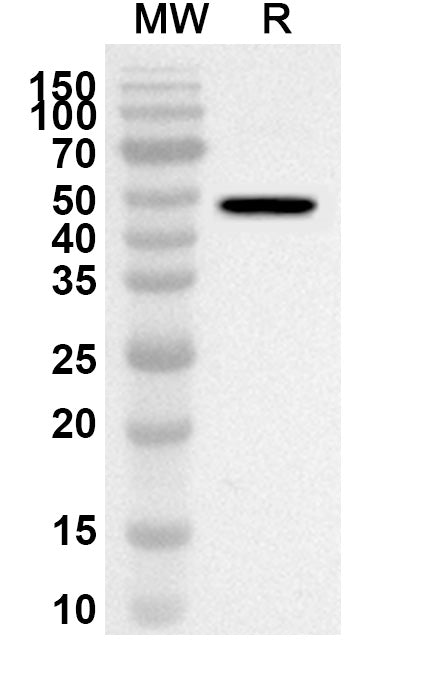 Western blot analysis was performed using anti-POLR2B polyclonal antibody at 1ug/mL on recombinant POLR2B (Catalog No. HA618012).