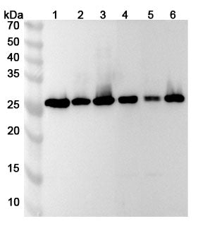 Western blot analysis was performed using anti-NAA10 polyclonal antibody at 1ug/mL on various samples.
Lane 1: 293T cell lysate
Lane 2: Hela cell lysate
Lane 3: MCF-7 cell lysate
Lane 4: HT-29 cell lysate
Lane 5: C2C12 cell lysate
Lane 6: H1299 cell lysate