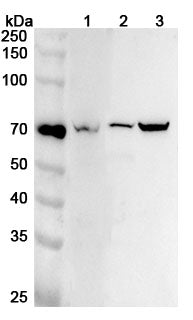 Western blot analysis was performed using anti-TEC  polyclonal antibody at 1ug/mL on various samples.
Lane 1: Mouse spleen lysate
Lane 2: Rat spleen lysate
Lane 3: Rat liver lysate