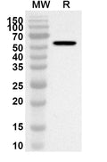 Western blot analysis was performed using anti-MATK polyclonal antibody at 1ug/mL on recombinant MATK (Catalog No. HA638012).