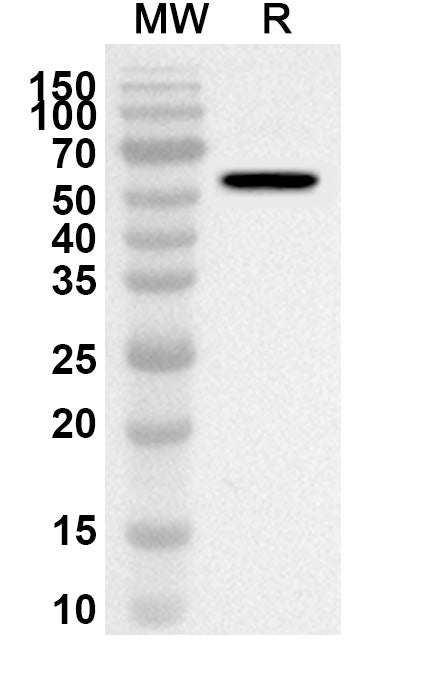 Western blot analysis was performed using anti-MATK polyclonal antibody at 1ug/mL on recombinant MATK (Catalog No. HA638012).