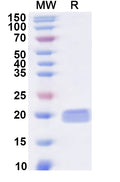 Recombinant Human CDKN2C Protein, N-His