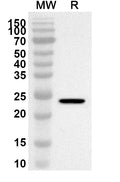 Western blot analysis was performed using anti-PTDSS1 polyclonal antibody at 1ug/mL on recombinant PTDSS1 (Catalog No. HA644012).