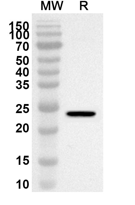 Western blot analysis was performed using anti-PTDSS1 polyclonal antibody at 1ug/mL on recombinant PTDSS1 (Catalog No. HA644012).