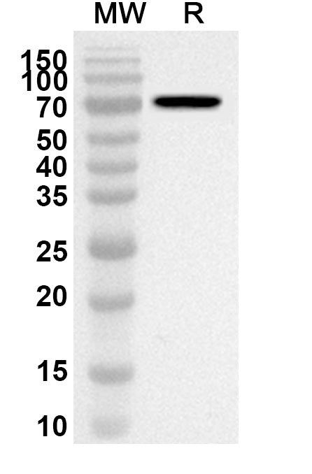 Western blot analysis was performed using anti-EVX1 polyclonal antibody at 1ug/mL on recombinant EVX1 (Catalog No. HA652012).