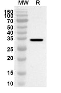 Western blot analysis was performed using anti-TTPA polyclonal antibody at 1ug/mL on recombinant TTPA (Catalog No. HA653012).