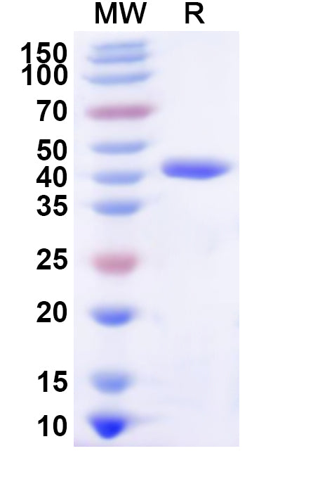 Recombinant Human CDK7 Protein, N-His