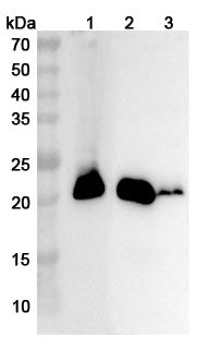 Western blot analysis was performed using anti-CSRP3 polyclonal antibody at 1ug/mL on various samples.
Lane 1: Mouse heart lysate
Lane 2: Rat heart lysate
Lane 3: Rat skeletal muscle lysate