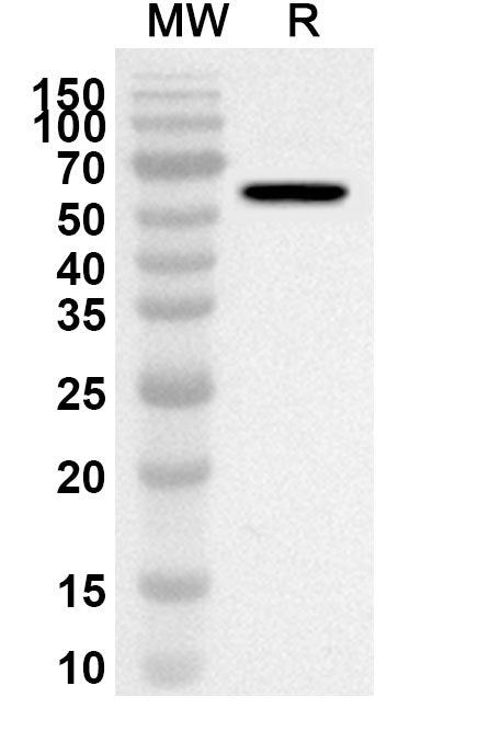 Western blot analysis was performed using anti-TAL1 polyclonal antibody at 1ug/mL on recombinant TAL1 (Catalog No. HA670012).