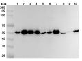 Western blot analysis was performed using anti-ST13 polyclonal antibody at 1ug/mL on various samples.
Lane 1: NIH3T3 cell lysate
Lane 2: Hela cell lysate
Lane 3: A431 cell lysate
Lane 4: A549 cell lysate
Lane 5: Mouse brain lysate
Lane 6: Mouse spleen lysate
Lane 7: Mouse testis lysate
Lane 8: Rat brain lysate
Lane 9: Rat spleen lysate
Lane 10: Rat testis lysate