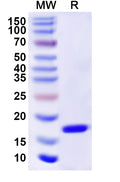Recombinant Human RAD52 Protein, N-His