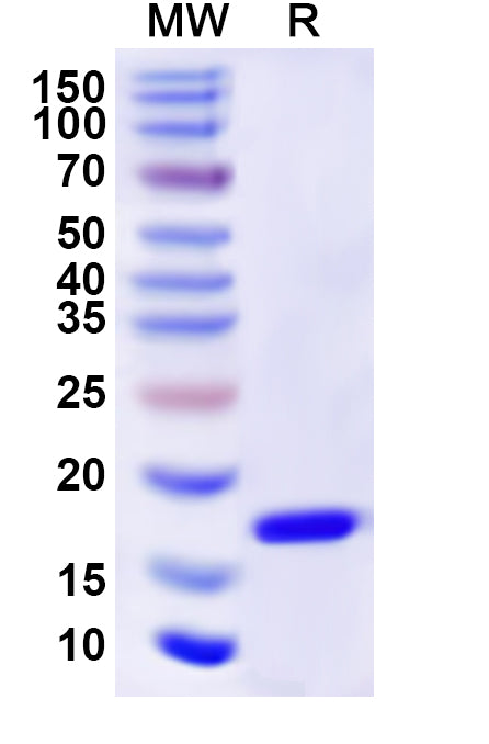 Recombinant Human RAD52 Protein, N-His