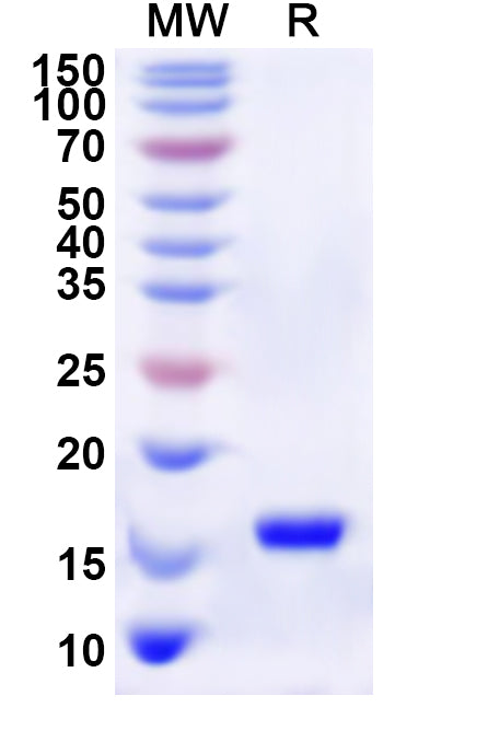 Recombinant Human GDF1 Protein, N-His