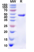 Recombinant Human RPA1 Protein, N-His