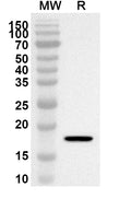 Western blot analysis was performed using anti-POLR2I polyclonal antibody at 1ug/mL on recombinant POLR2I (Catalog No. HA703012).