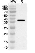 Western blot analysis was performed using anti-PDLIM4 polyclonal antibody at 1ug/mL on recombinant PDLIM4 (Catalog No. HA712012).