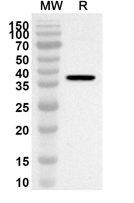 Western blot analysis was performed using anti-PDLIM4 polyclonal antibody at 1ug/mL on recombinant PDLIM4 (Catalog No. HA712012).
