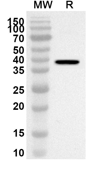 Western blot analysis was performed using anti-RPS25 polyclonal antibody at 1ug/mL on recombinant RPS25 (Catalog No. HA736012).