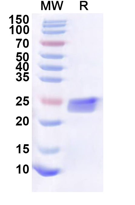 Recombinant Human BBIP1 Protein, N-His-KSI