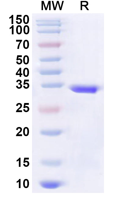 Recombinant Human NUPR1 Protein, N-His-KSI