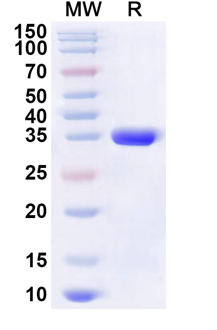 Recombinant Human BEX3 Protein, N-His-KSI