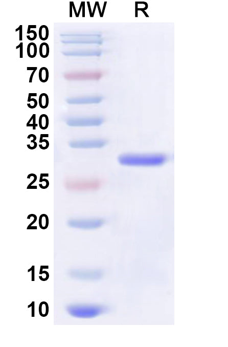 Recombinant Human CREM Protein, N-His-KSI