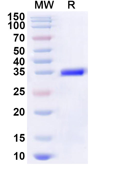 Recombinant Human MOBP Protein, N-GST & C-His