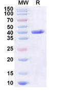 Recombinant Human DGCR6 Protein, N-His-KSI