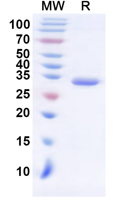 Recombinant Human SS18 Protein, N-His-KSI