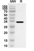 Western blot analysis was performed using anti-SS18 polyclonal antibody at 1ug/mL on recombinant SS18 (Catalog No. HA764012).