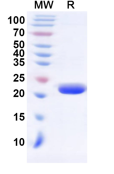 Recombinant Human E2F5 Protein, N-His