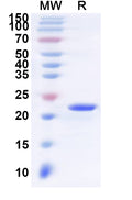 Recombinant Human LTB4R Protein, N-His-KSI