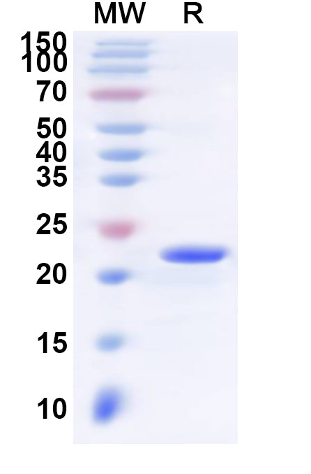 Recombinant Human LTB4R Protein, N-His-KSI