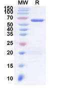 Recombinant Human VPS72 Protein, N-His-KSI