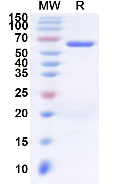 Recombinant Human VPS72 Protein, N-His-KSI