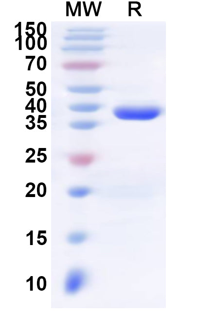 Recombinant Human SSX2 Protein, N-His-KSI