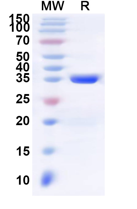 Recombinant Human LCE5A Protein, N-His-KSI