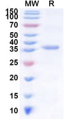 Recombinant Human KRTAP13-2 Protein, N-His-KSI