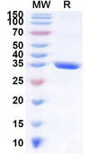 Recombinant Human RNF220 Protein, N-GST & C-His