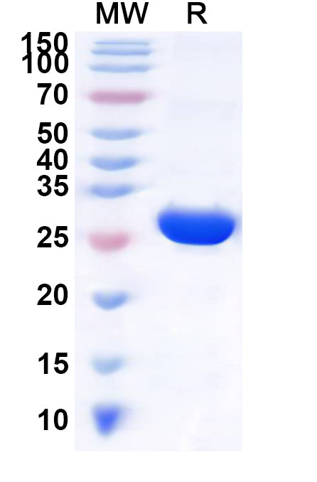 Recombinant Human NKG7 Protein, N-GST & C-His