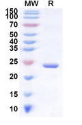 Recombinant Human SLC6A19 Protein, N-His-KSI