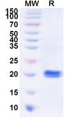 Recombinant Human KRT39 Protein, N-His