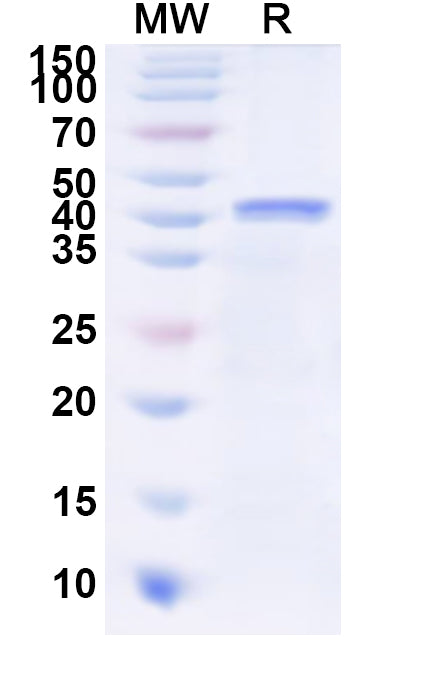 Recombinant Human PSG9 Protein, N-His