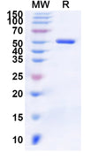 Recombinant Human ALDH6A1 Protein, N-His